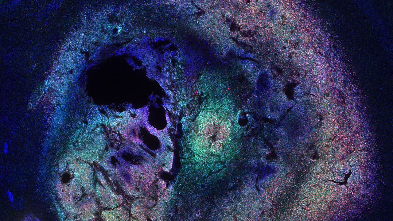 Picture of murine brain tumor
